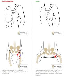 InternationalHipDysplasiaInstitute
